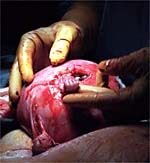  Photo of unborn child grasping doctor's finger by Michael Clancy